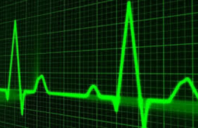 Los latidos del corazón podrían ser contraseñas para historias clínicas