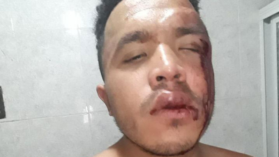 Ataque homofóbico a un joven en Resistencia