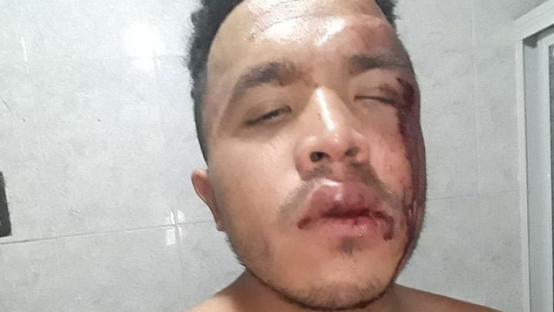 Ataque homofóbico a un joven en Resistencia