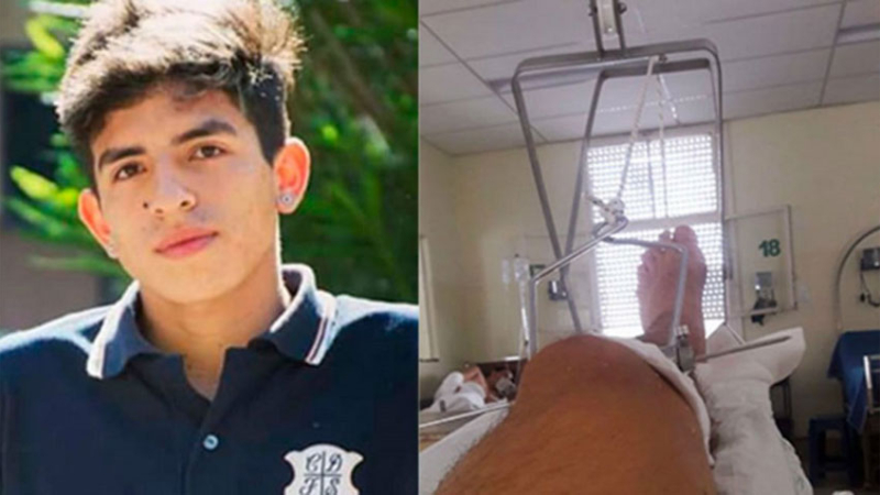 Un joven recibió una golpiza en una fiesta y le rompieron el fémur