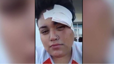 Cinco hombres golpearon a una chica en un ataque homofóbico