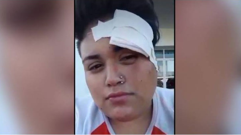 Cinco hombres golpearon a una chica en un ataque homofóbico