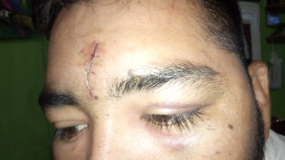 Por un cigarrillo: Joven fue brutalmente golpeado por una patota
