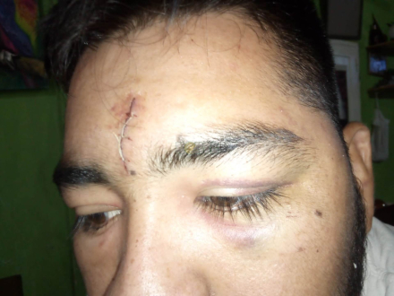 58joven agredido.jpeg