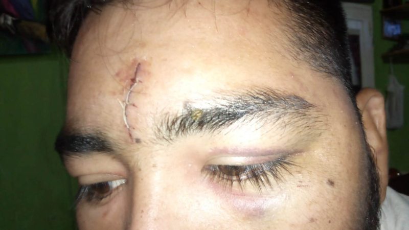 Por un cigarrillo: Joven fue brutalmente golpeado por una patota