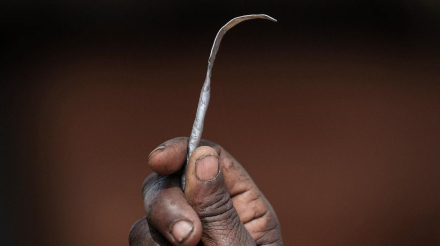 mutilacion genital