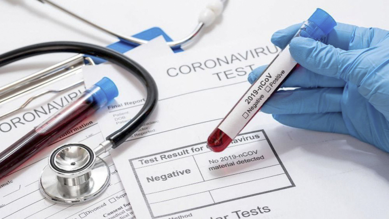 Confirmaron 406 muertes y 11.712 nuevos contagios en las últimas 24 horas
