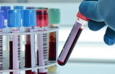 Coronavirus en el Chaco: 5 muertos y 192 nuevos contagios en las últimas 24 horas