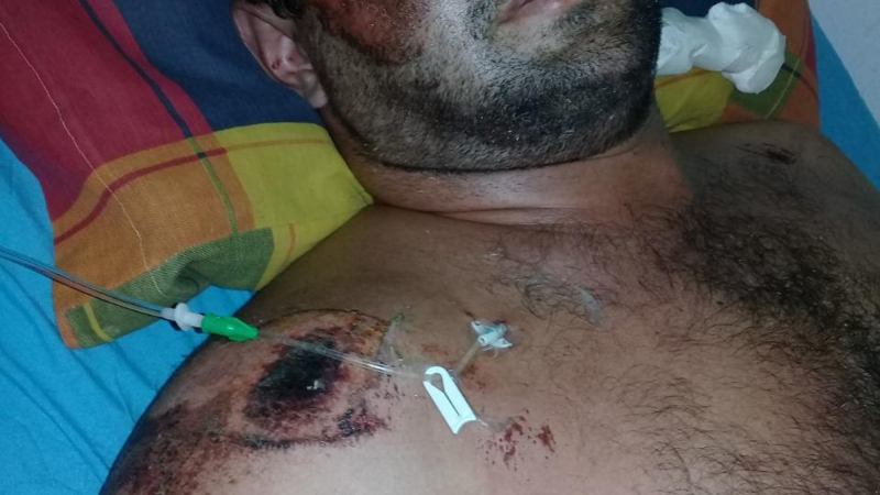 Arranca un juicio por jurados contra policías por la muerte de un detenido