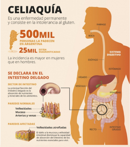 celiacos.jpg