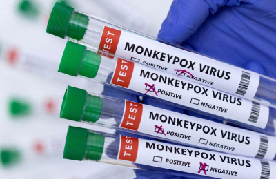 Perú: más de 1000 casos de viruela del mono