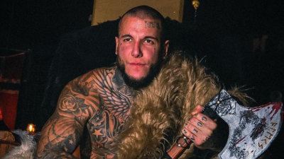 Alex Caniggia se hizo un retoque estético y sorprendió con su nuevo rostro