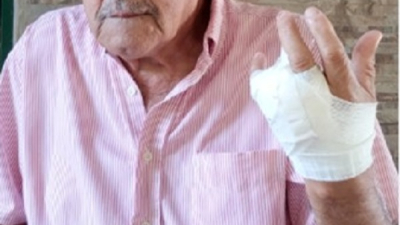 El camarógrafo "Wily" Vázquez se accidentó y perdió un dedo de la mano