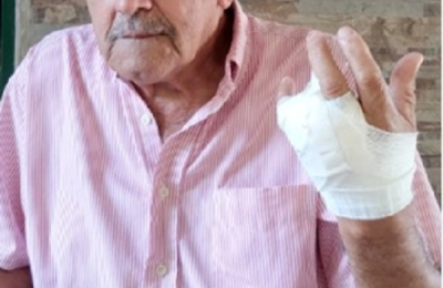 El camarógrafo "Wily" Vázquez se accidentó y perdió un dedo de la mano