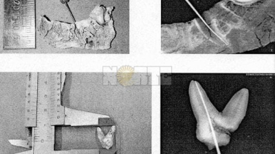 Causa Cecilia: dudas por restos dentarios obligan a un estudio genético
