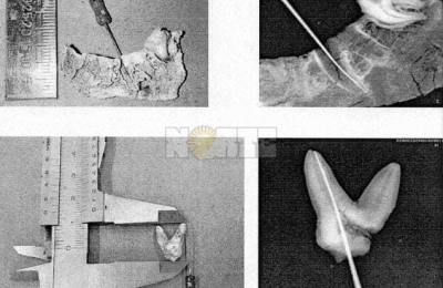 Causa Cecilia: dudas por restos dentarios obligan a un estudio genético