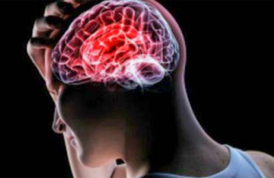 Cómo proteger el cerebro del ACV y Alzheimer