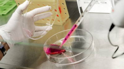 Alentadores avances en el desarrollo del test para detectar cáncer de mama y de próstata