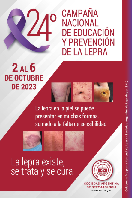 CAMPANA-LEPRA-2023.jpg