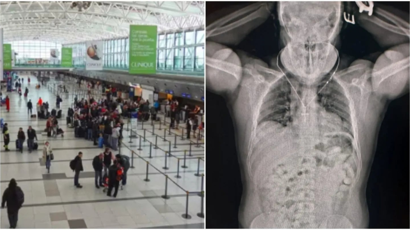 Intentaba viajar a España con 84 cápsulas de cocaína en su estómago