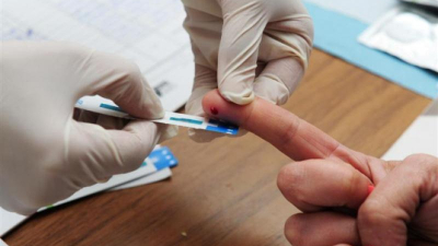 ¿Cuáles son las medidas preventivas, diagnóstico y tratamiento del VIH?