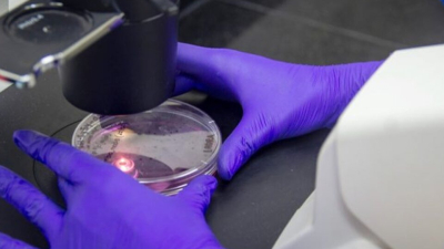 Mal de Parkinson: el proyecto del Conicet que podría ayudar a combatir la enfermedad