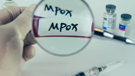 mpox.jpg
