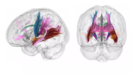 cerebro madre.jpg