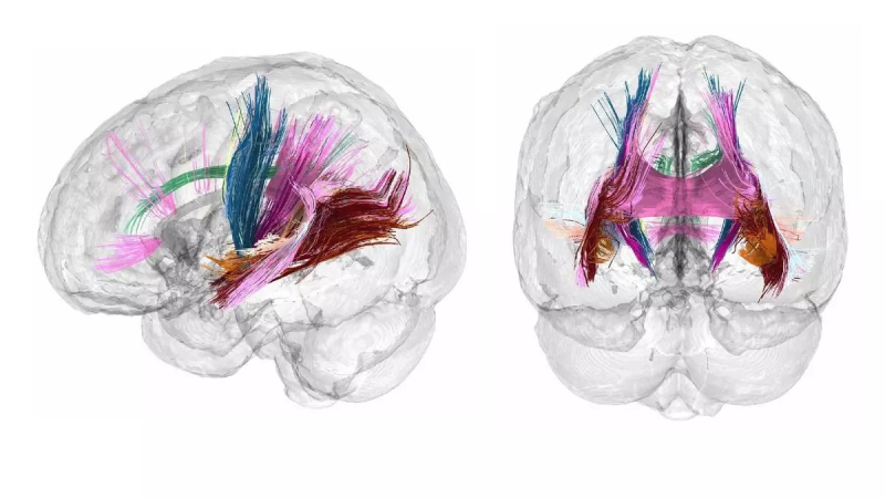 Los cambios que "esculpen" el cerebro de la madre durante el embarazo