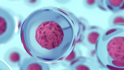 Una mujer vuelve a producir insulina tras tratamiento con células madre