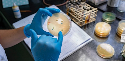 Búsqueda y detección de patógenos en el Malbrán, principal centro de referencia epidemiológica del país..jpg
