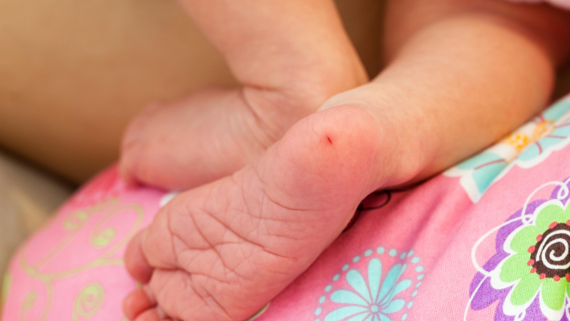 Fenilcetonuria: una enfermedad poco frecuente con consecuencias prevenibles