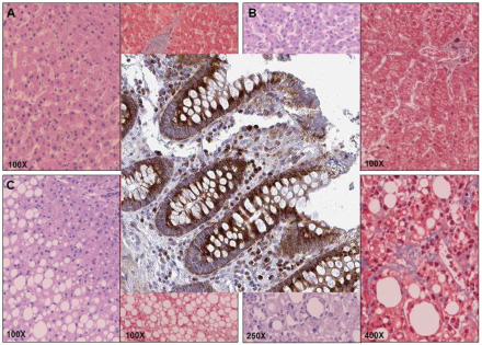 olfactomedin-2 (OLFM2)b.jpg