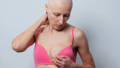 La importancia de la detección temprana de cáncer de mama y los números que alertan a la Argentina