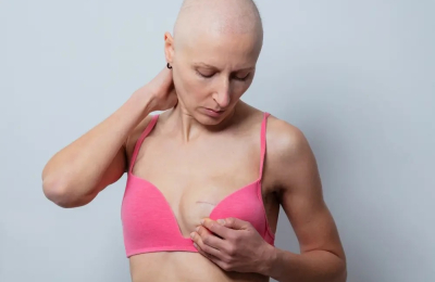 La importancia de la detección temprana de cáncer de mama y los números que alertan a la Argentina