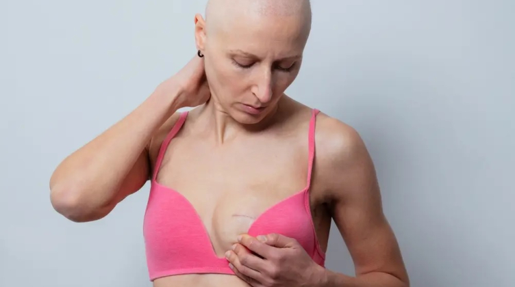 La importancia de la detección temprana de cáncer de mama y los números que alertan a la Argentina