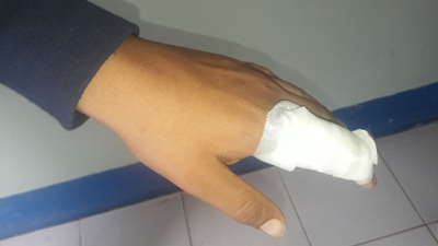 Un adolescente fue atacado por otro con un cuchillo en un colegio de Las Breñas