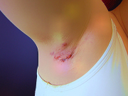 dermis.jpg