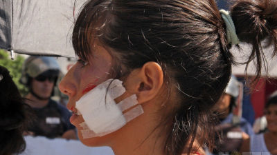 Violencia de género: las denuncias disminuyeron un 50 por ciento
