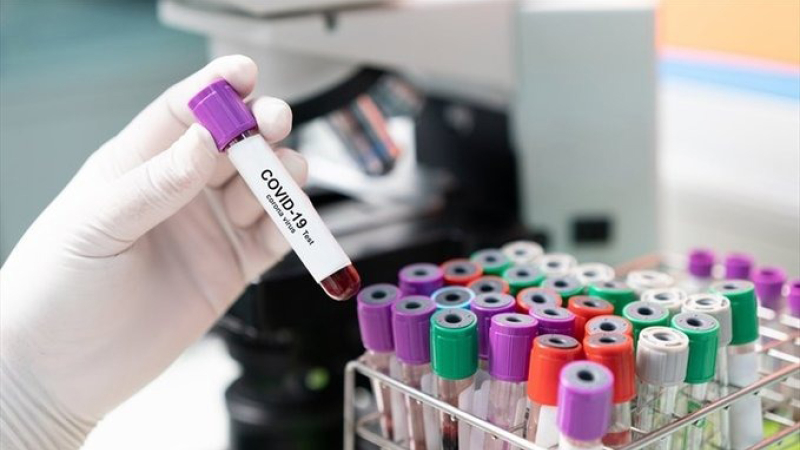 24 muertos y 255 nuevos casos en las últimas 24 horas, informó el Ministerio de Salud