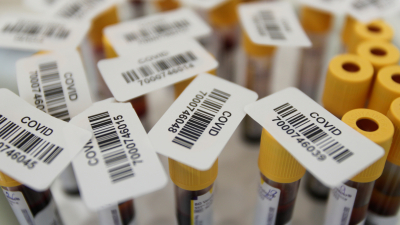 Rusia se adelanta en la carrera y registra la primera vacuna contra el coronovirus