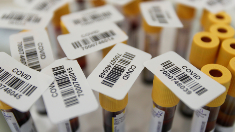 Rusia se adelanta en la carrera y registra la primera vacuna contra el coronovirus