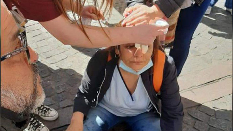La policía agredió a enfermeros que marchaban en Buenos Aires