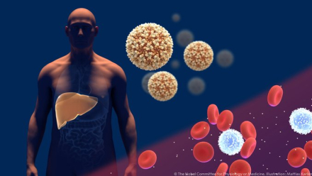 hepatitis.jfif