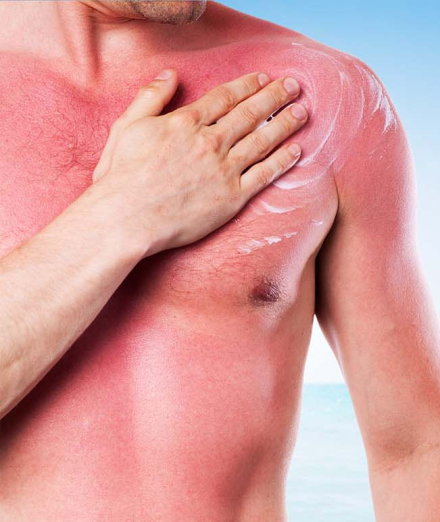 calor2.jpg