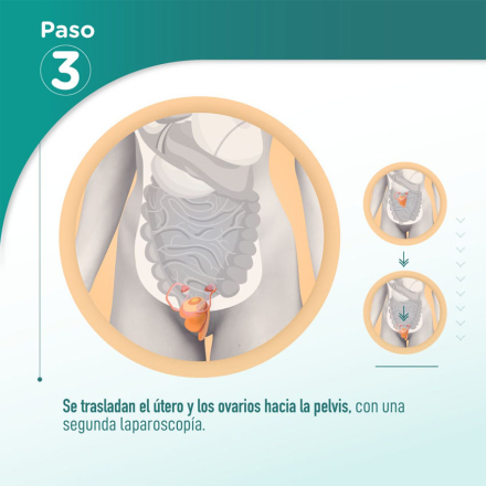 paso3.jpg