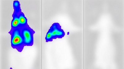 Logran grabar cómo se propaga el virus del covid en el cuerpo y cuándo mata