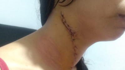Abusó de su exmujer y quiso matarla: le dictaron prisión preventiva