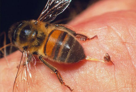 picadura-abejas.jpg