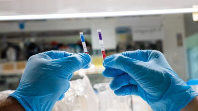 Coronavirus: confirmaron 57 muertos y 10.614 nuevos contagios en Argentina